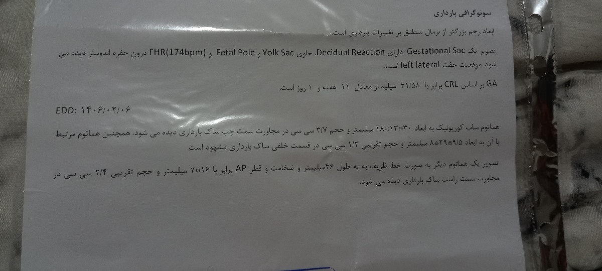 ترشح یهویی با حجم زیاد
