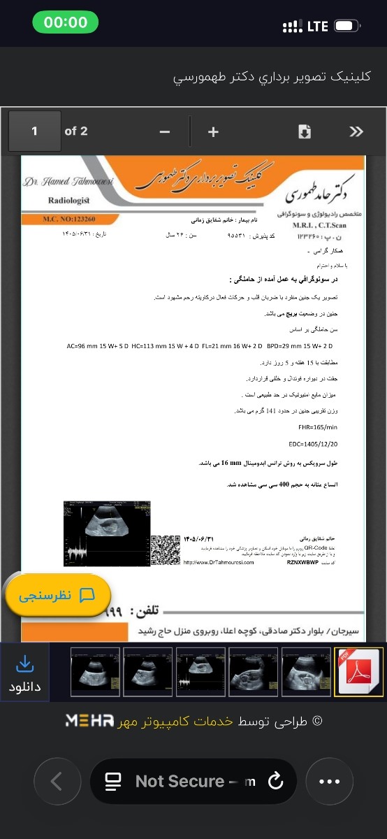 کورتاژ سقط ۱۵هفتگی مدارک کورتاژ سقط ۱۵هفتگی مدارک