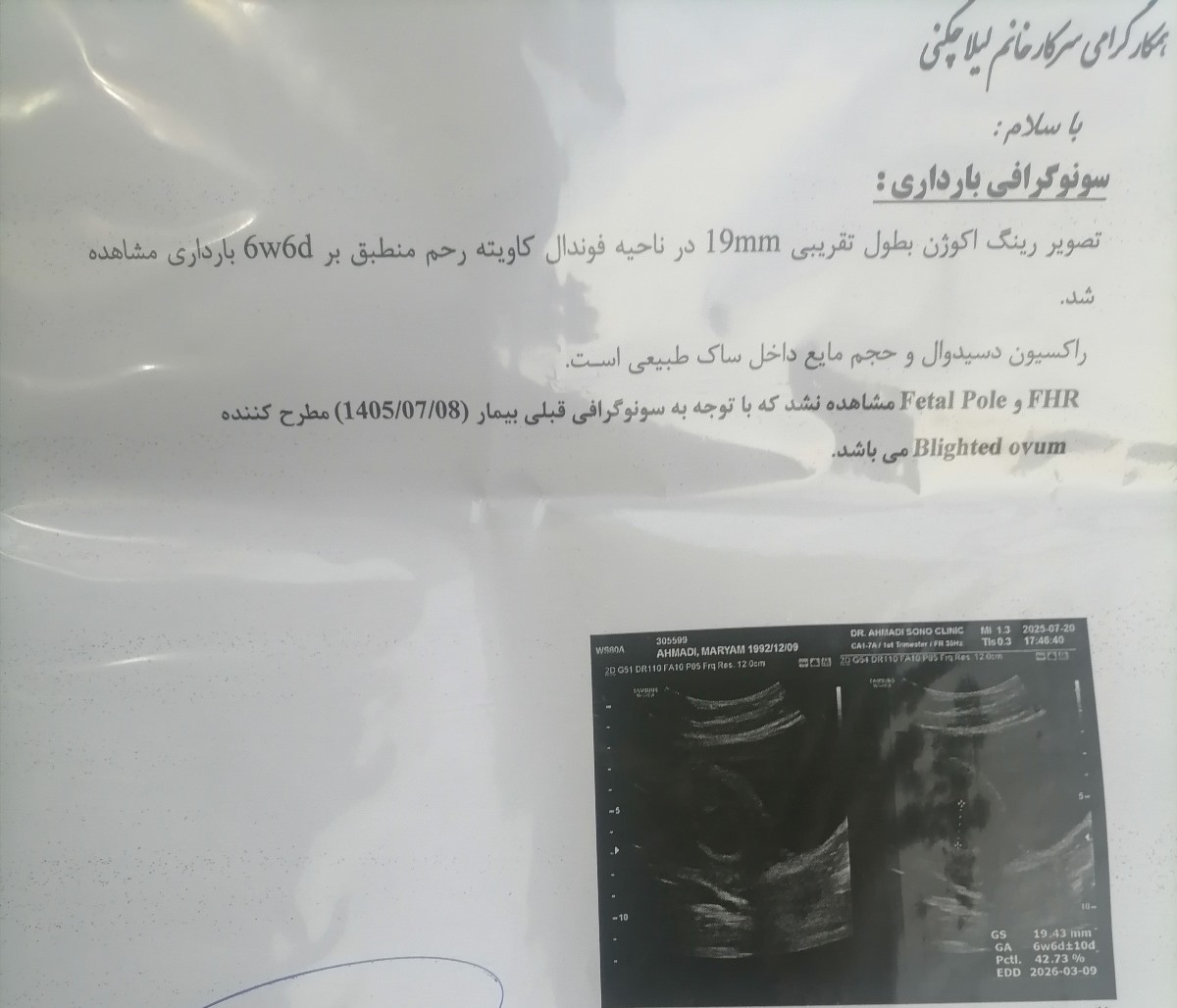 دکتر اوما لطفاً سنو ی من رو تفسیر کنید