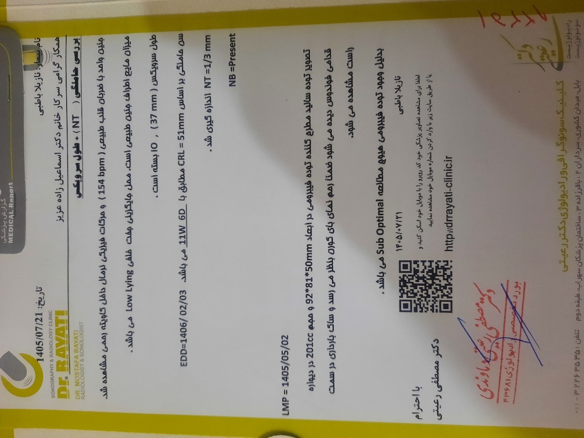 جواب سونو جواب سونو