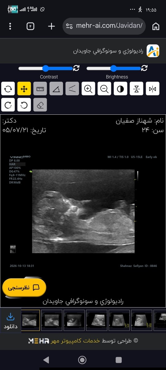 سونو ان تی و تغیر تاریخ سونو ان تی و تغیر تاریخ