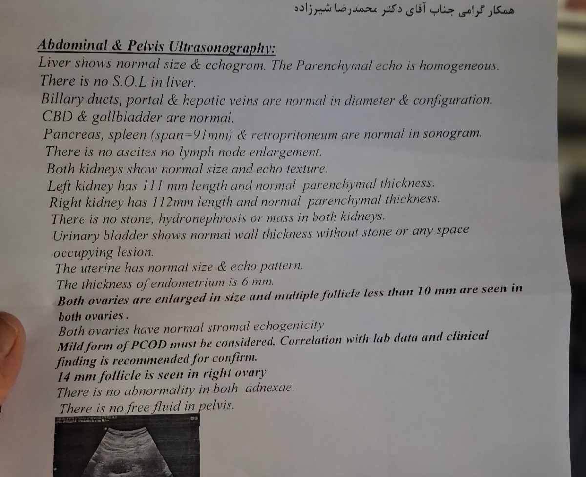 روز ۱۲ سیکل
سیکل ۳۰تا ۳۱ روزه