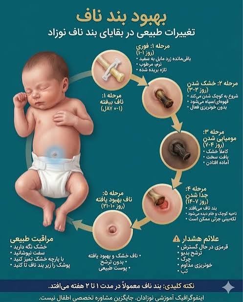 نتونستم از نوزادم عکس بگیرم ولی دقیقا مشابه مرحله چهار شده نتونستم از نوزادم عکس بگیرم ولی دقیقا مشابه مرحله چهار شده