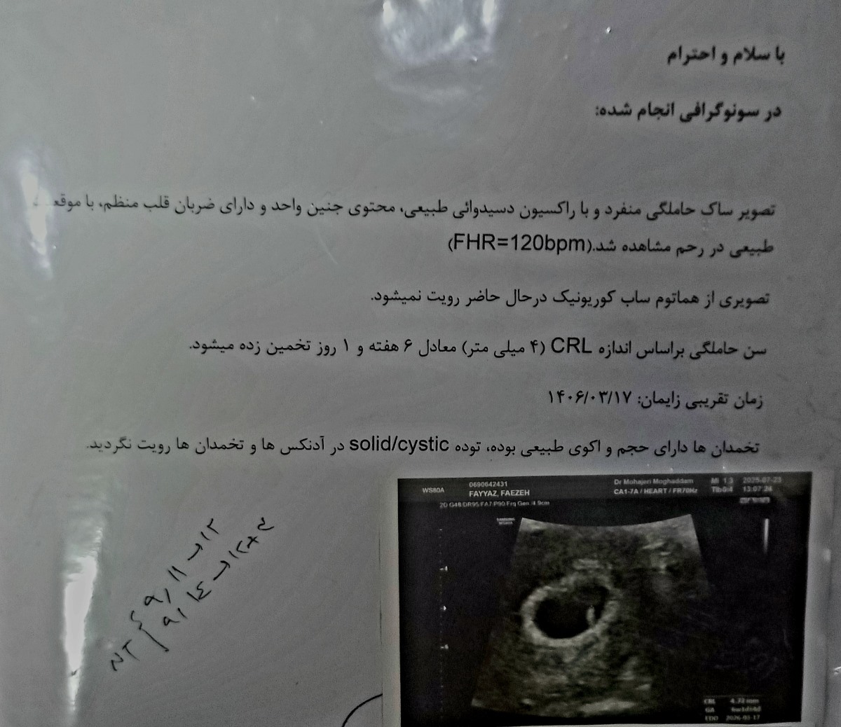 لکه بینی با وجود شیاف پروژسترون لکه بینی با وجود شیاف پروژسترون