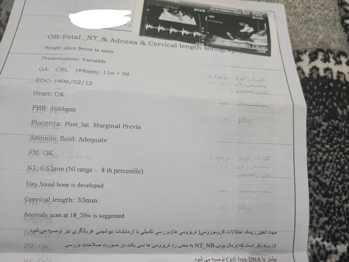 تفسیر سونوگرافی ان تی