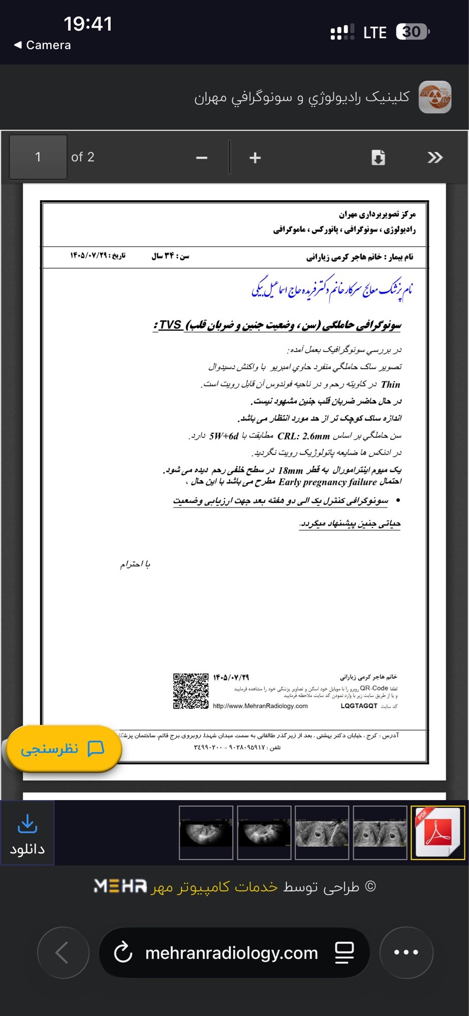 سونو جدید