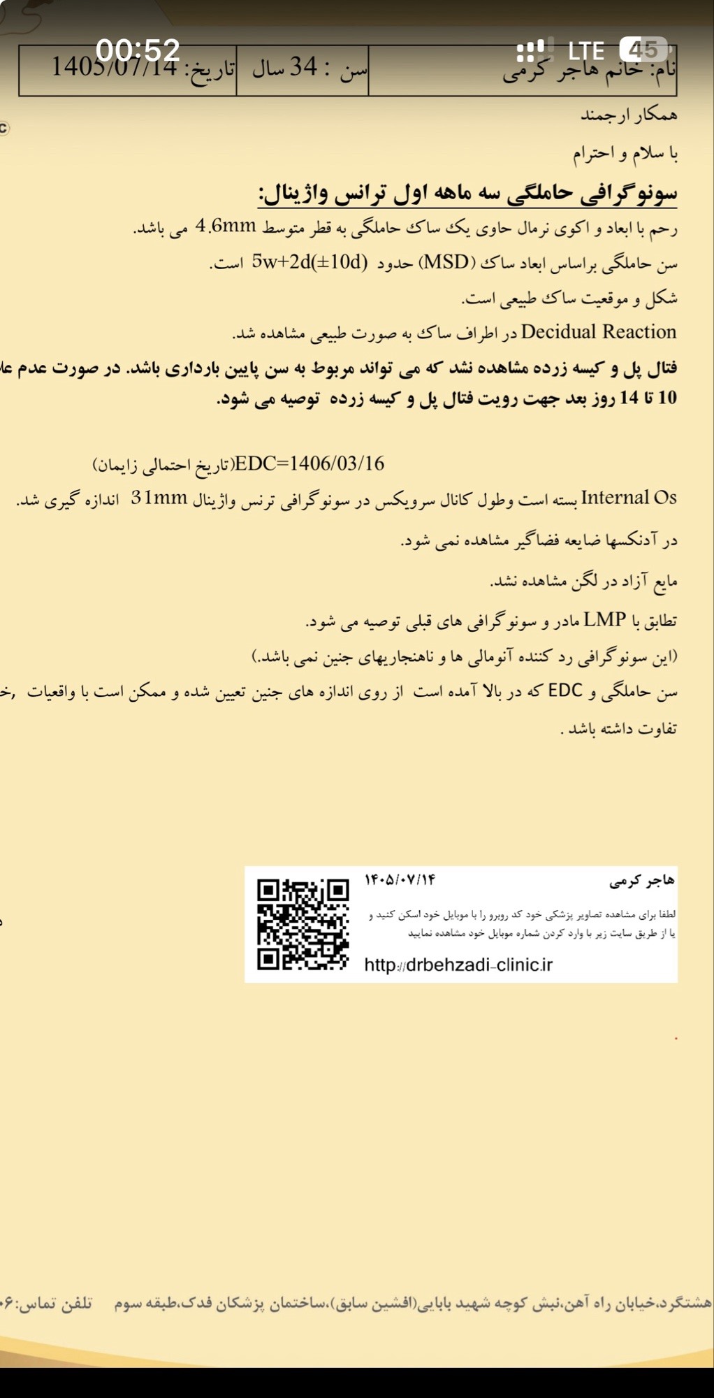 اولی