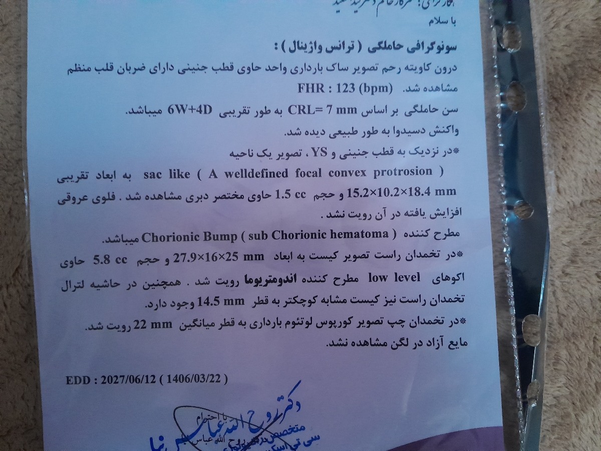 سنو که دیروز شدم 