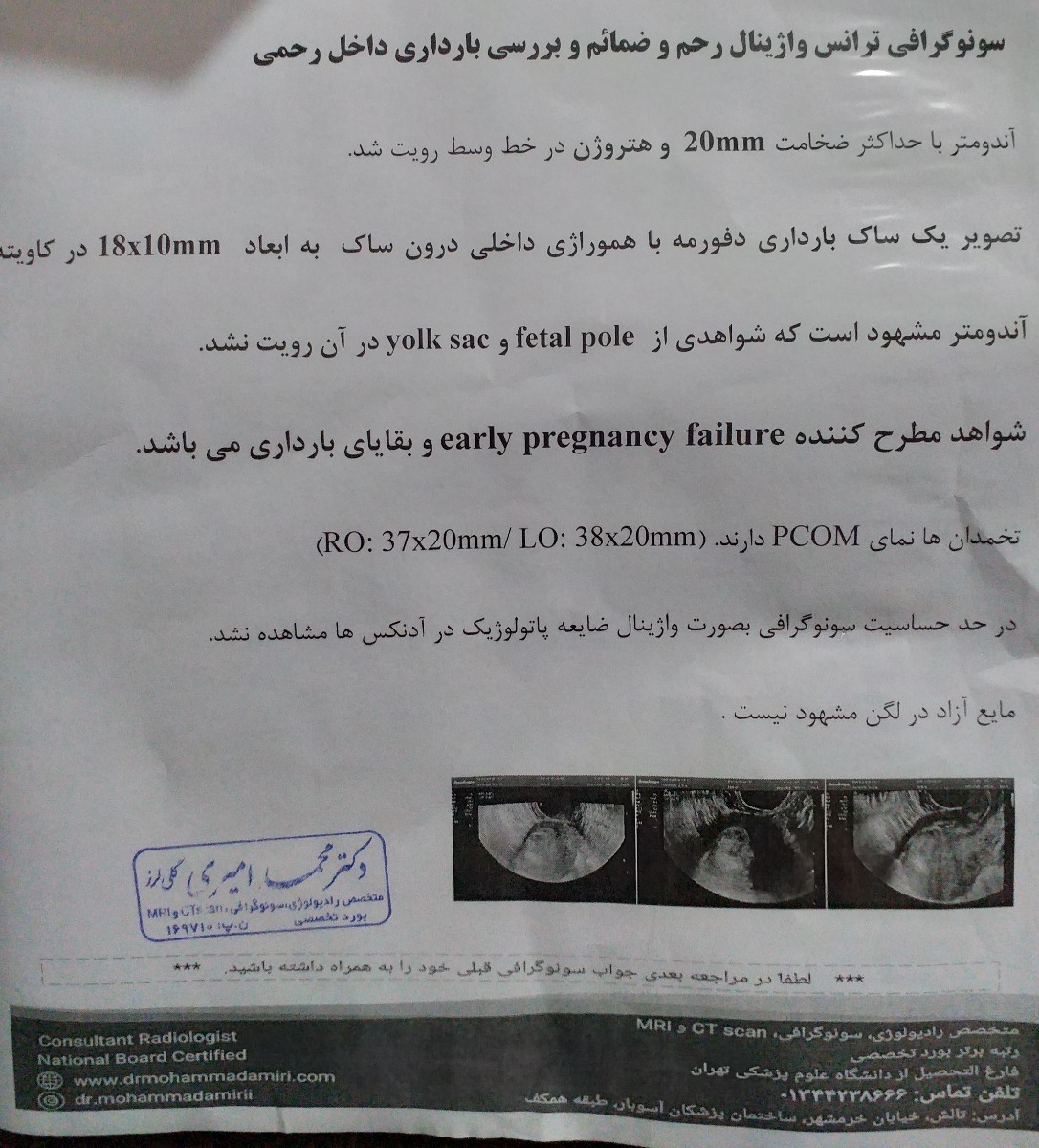 لکه بینی و ترشح خونی در اوایل بارداری